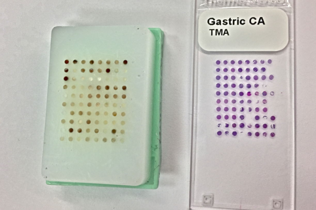 TMA's available (NEW) | Cooperative Human Tissue Network Western Division