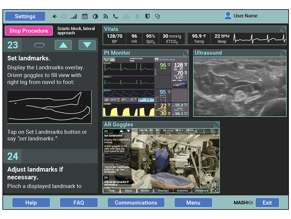 Tablet interface for augmented reality surgical guidance app