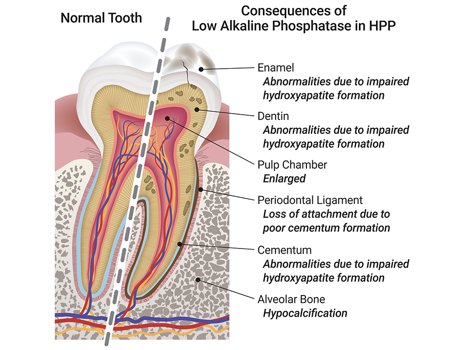 Tooth cutaway illustration