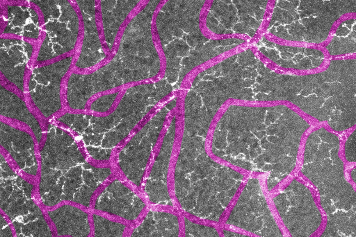 Ib4 Staining Rpe Welcome | De La Huerta Lab