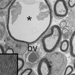 D periaxonal.jpg