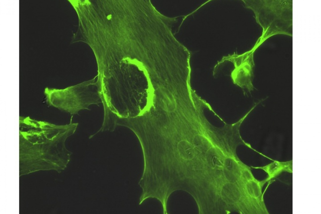 Actin Ruffle Photo Gallery | Denison Lab