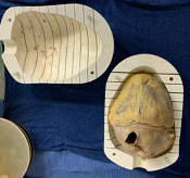 Post-Mortem Heart in MRI Holder