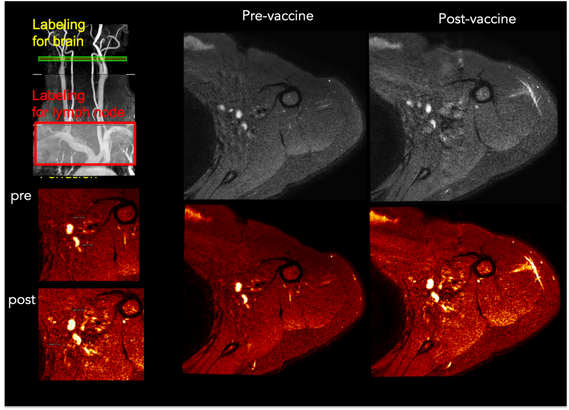 HIV Image