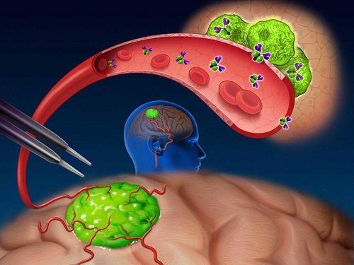 brain tumor antibodies