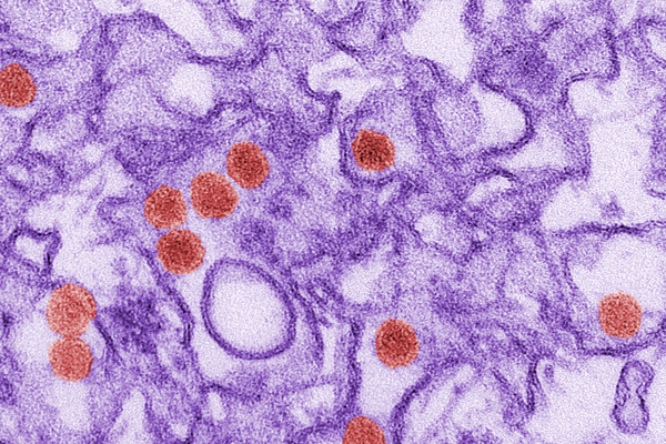 Zika virus