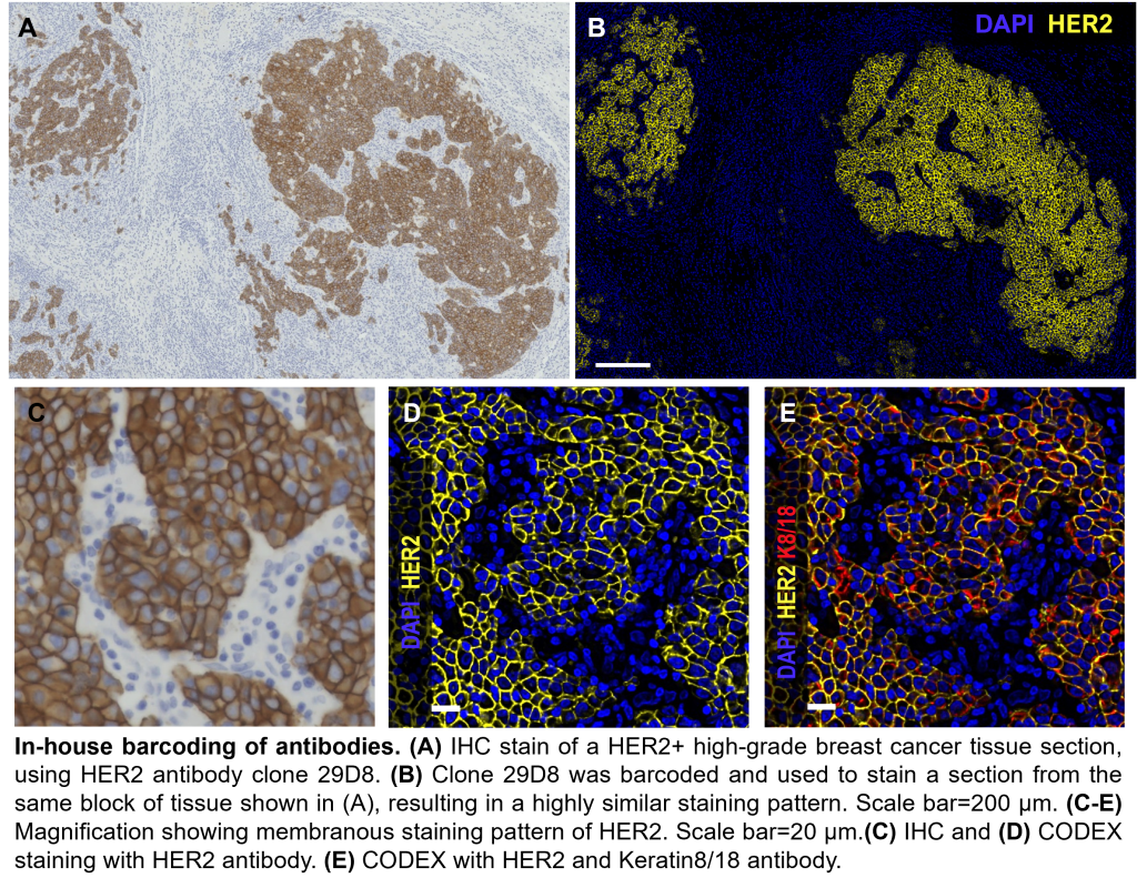 Barcoding of HER2 antibody