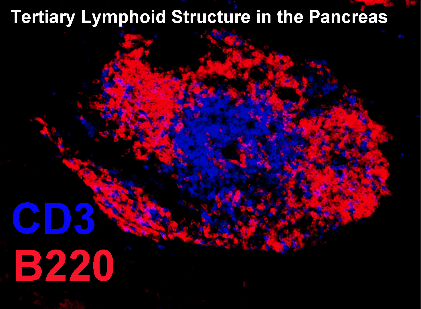 TLO Pancreas.jpg