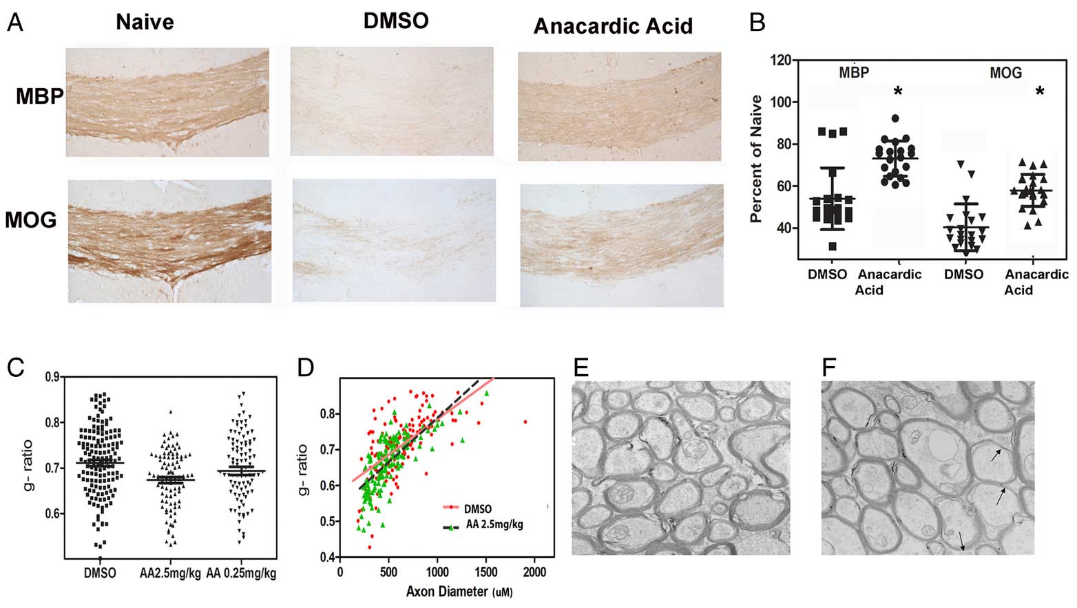 Novel remyelinating therapies for multiple sclerosis