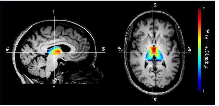 Translational Neurodegeneration Research Laboratory