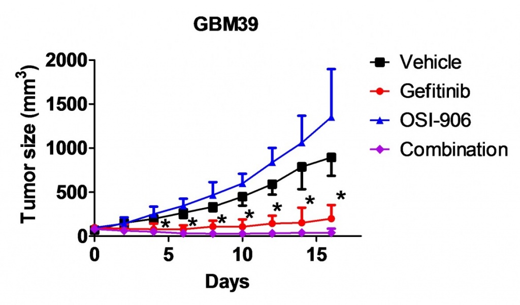 glioblastoma3