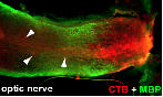 opticnerve.png