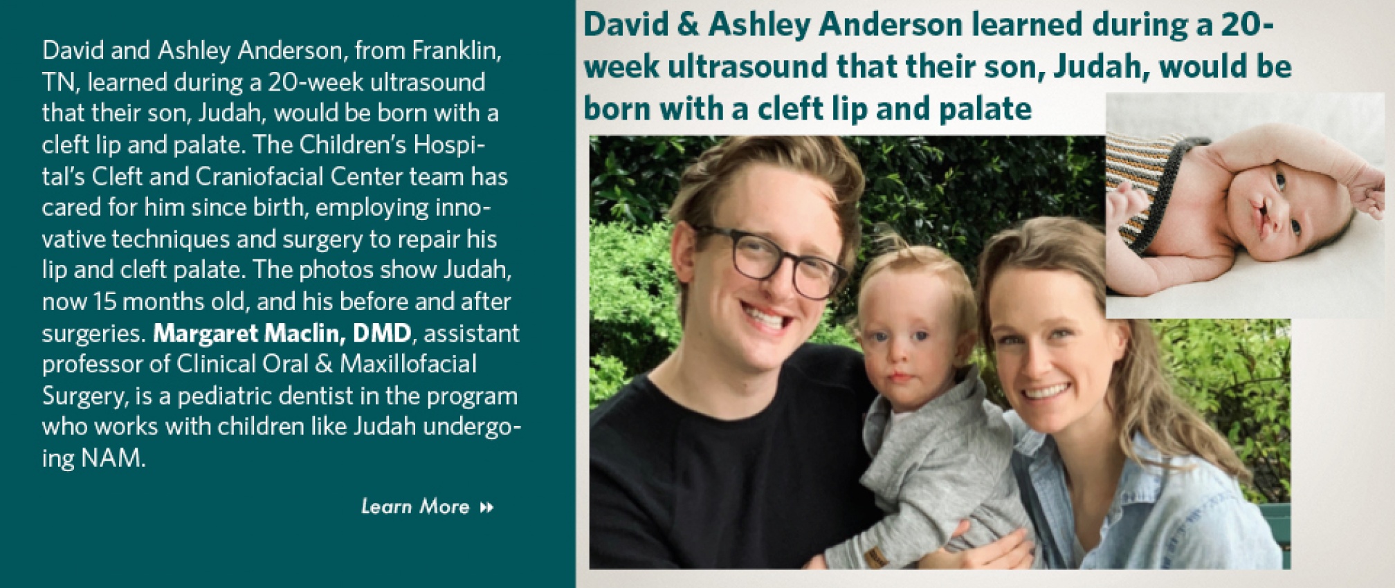 Scott Rapp Adult and Children's Cleft & Craniofacial Surgery | Department of ...