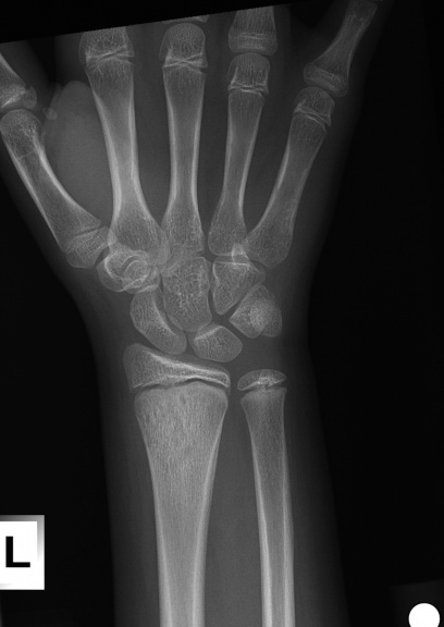 Child with wrist pain | Department of Radiology