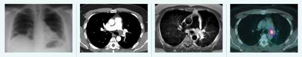 Xray-CT-MRI-PET.png