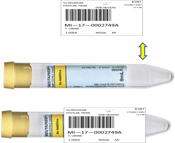 urine vacutainer label placement