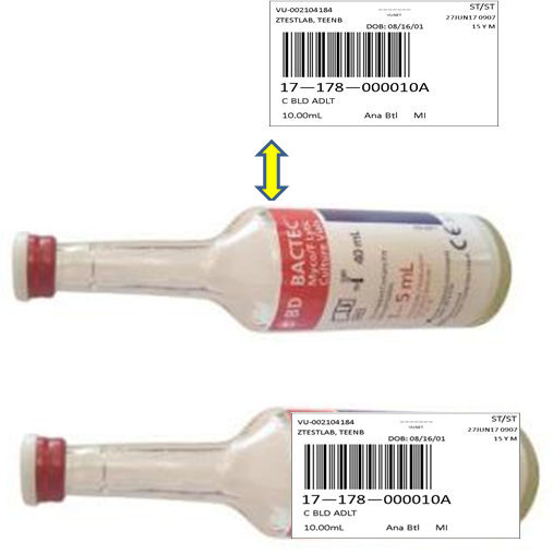 bottle label placement