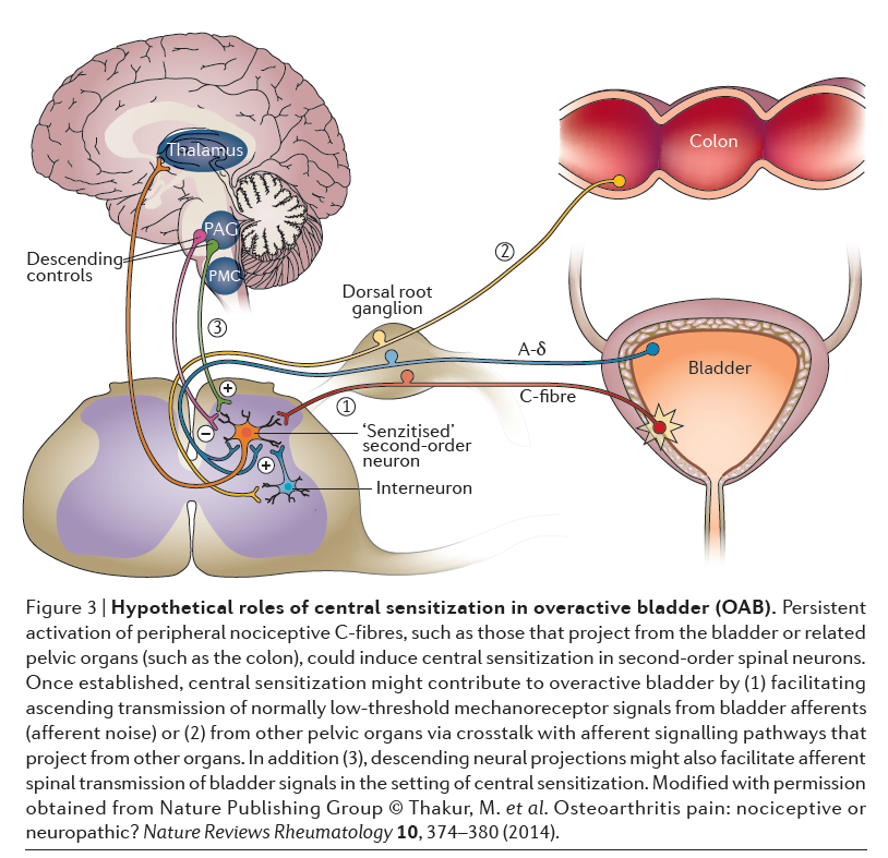 Hypothetical roles of central sensitization in overactive bladder