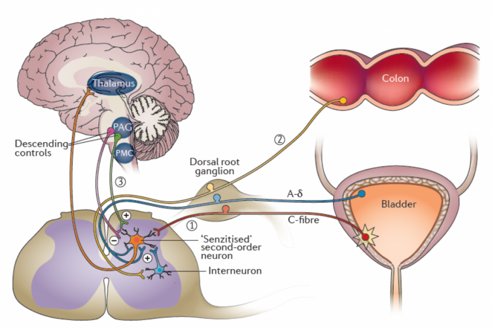 Hypothetical roles of central sensitization in overactive bladder