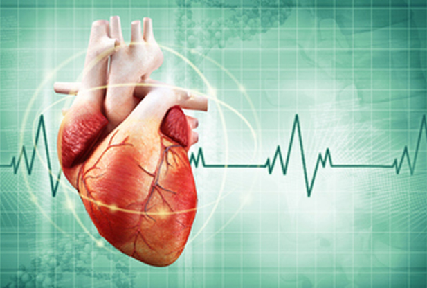 Arrhythmia image