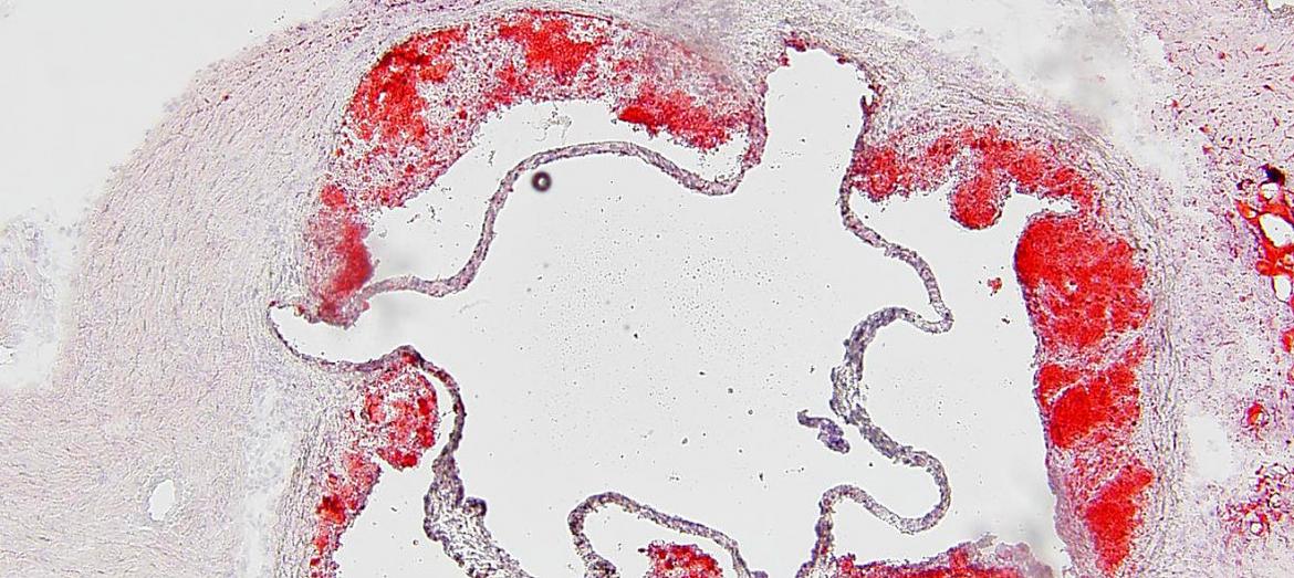 Immunometabolism and Metabolic Disease.jpg