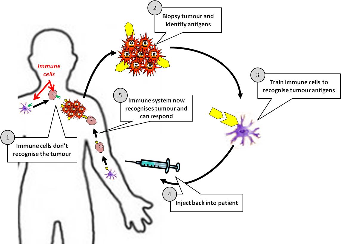 How does cancer vaccines typically work