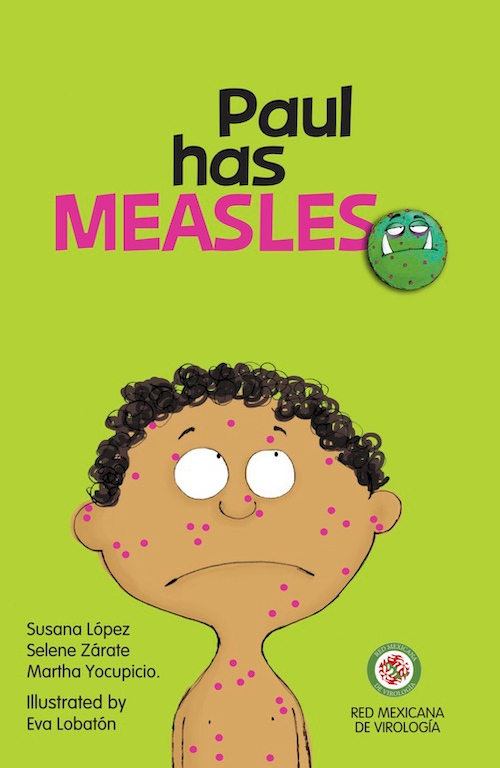 Paul Has Measles 