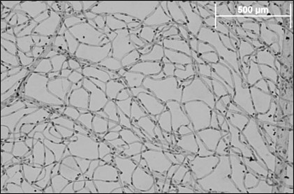 trypsin digest.jpg